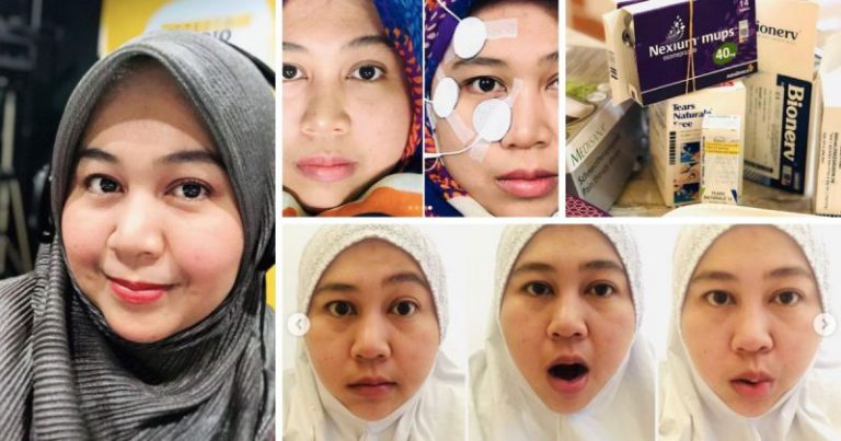 “Bangun Pagi Muka Senget” – Peneraju Bernama Radio Ini Kongsi Pengalaman Alami ‘Bell’s Palsy’ “Bangun Pagi Muka Senget” – Peneraju Bernama Radio Ini Kongsi Pengalaman Alami ‘Bell’s Palsy’