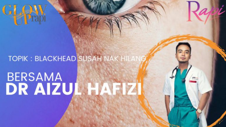 Cuci Muka Dengan Betul, Cara Mudah Kurangkan Blackhead Di Wajah Cuci Muka Dengan Betul, Cara Mudah Kurangkan Blackhead Di Wajah