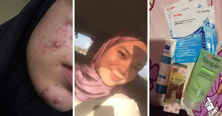 Bertahun Alami Masalah Jerawat, Gadis Kongsi Rutin Penjagaan Guna Produk Drugstore Bawah RM30 Bertahun Alami Masalah Jerawat, Gadis Kongsi Rutin Penjagaan Guna Produk Drugstore Bawah RM30