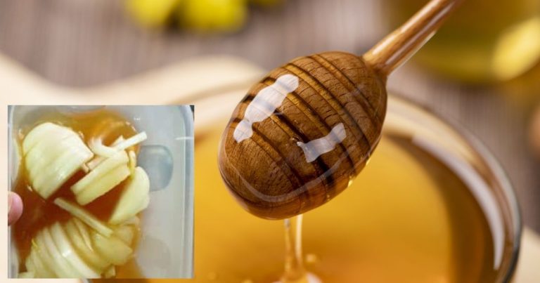 Campuran Madu & Bawang Holland, Cara Alternatif Legakan Masalah Batuk & Mudahkan Buang Kahak Campuran Madu & Bawang Holland, Cara Alternatif Legakan Masalah Batuk & Mudahkan Buang Kahak