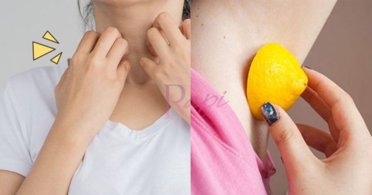 Hilangkan Daki Di Leher Dan Pelipat, Jangan Dibiar Kalau Tak Nak Nampak Kulit Gelap! Hilangkan Daki Di Leher Dan Pelipat, Jangan Dibiar Kalau Tak Nak Nampak Kulit Gelap!