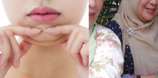 hilangkan dagu berlapis