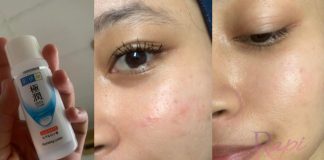 Kulit Kemerah-merahan