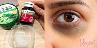 Lingkaran Hitam Bawah Mata