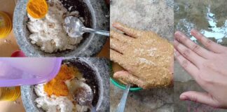 kulit putih semula jadi