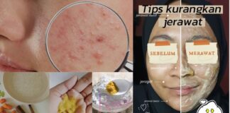 Kurangkan Masalah Jeragat