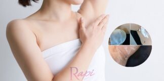 Cara Cerahkan Ketiak