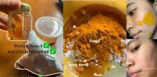 Pudarkan Parut Jerawat