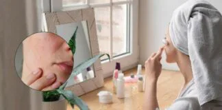 Tanda Pakai Skincare Tak Sesuai